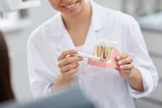 How Much Does A Tooth Implant Cost In Calgary?