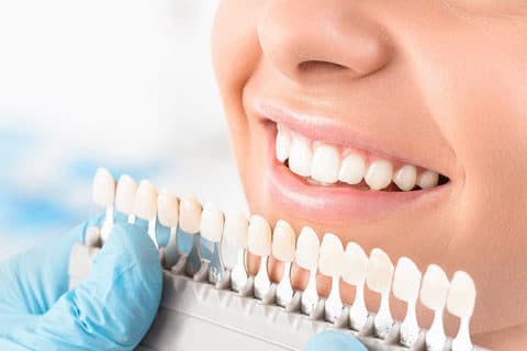 Dental Crowns