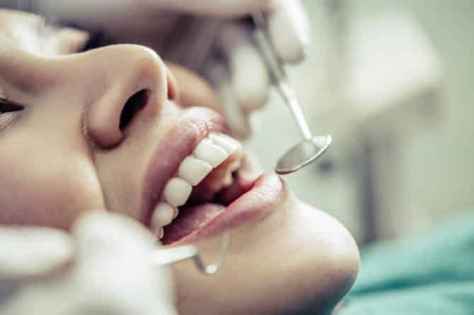 Gum Recession: Symptoms, Causes, and Treatment