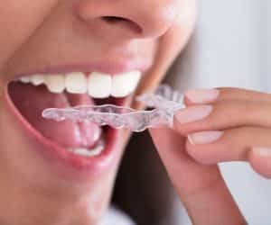 Woman using Invisalign aligner at home